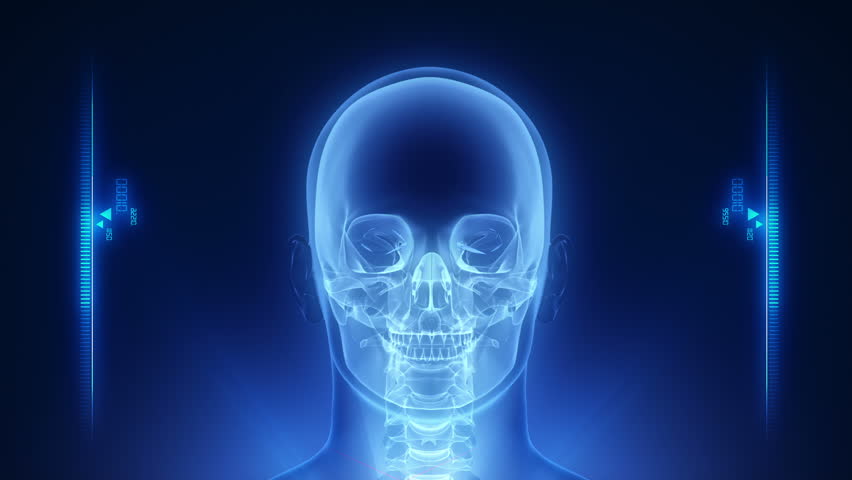 Human head x-ray scan