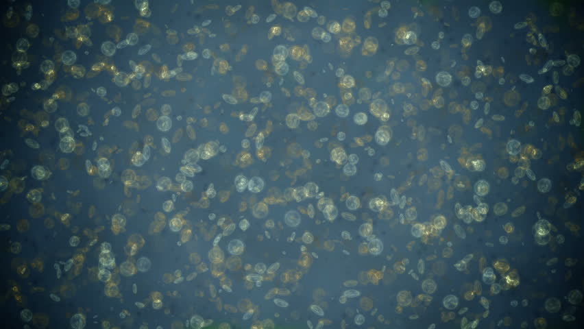 Bacteria under microscope