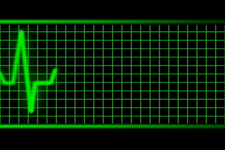 Green heart rate EKG beating NTSC seamless loopable