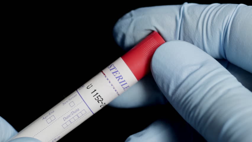DNA Swab