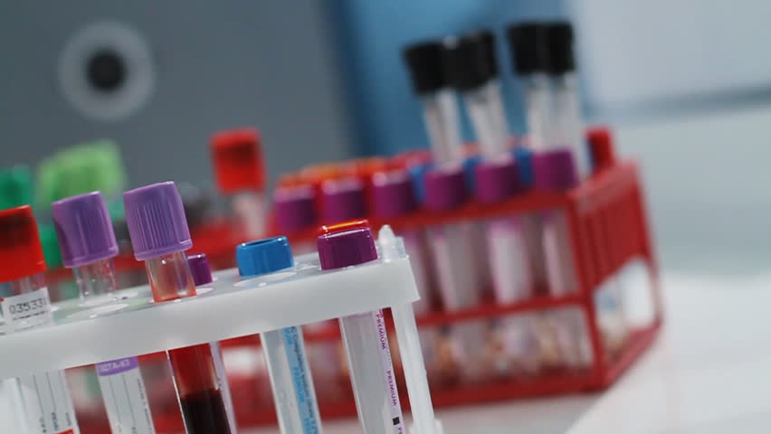 Nurse puts a test tube with the blood analysis in a support under laboratory flasks.
