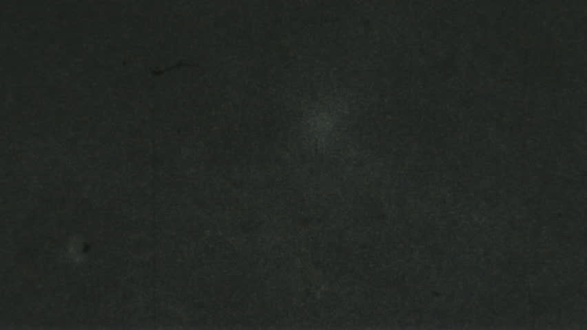 Microscopic Sperm Footage 3