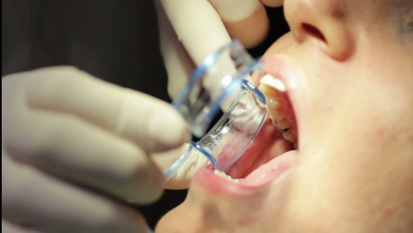 Close-up of patient open mouth during oral checkup