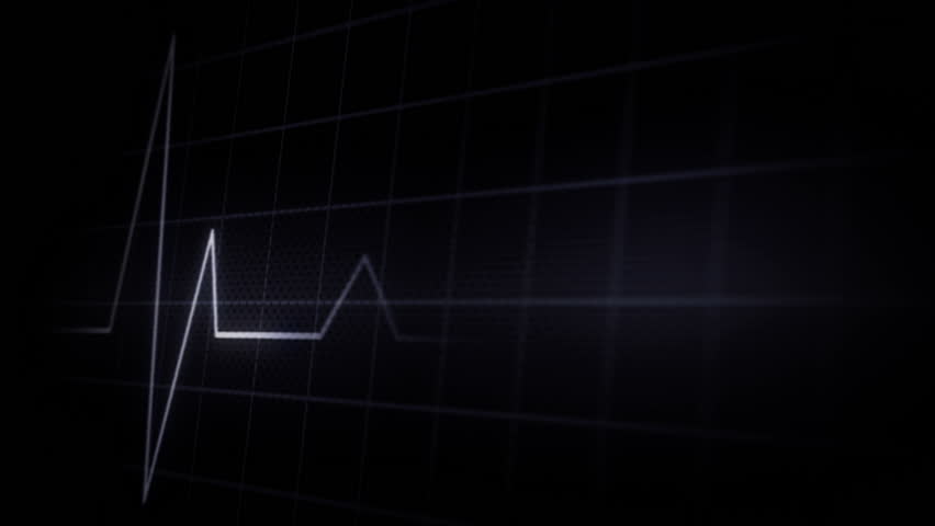 close up of a looping EKG display electrocardiogram pulse real waveform