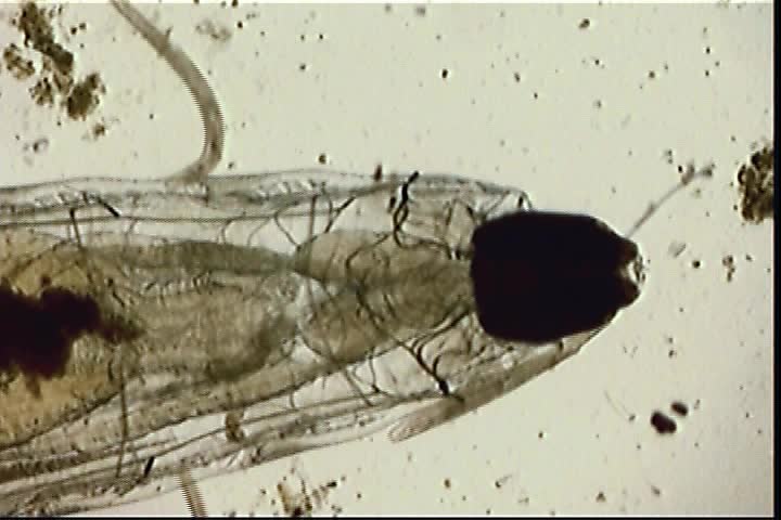 Microscopic: A large dormant fly larva lies among active protozoa in a multispecies culture.