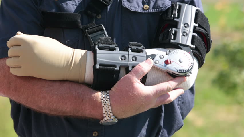 Man holding arm in pain prosthetic brace. Meant to restrict movement and stabilize elbow after surgery.