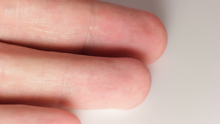 Disinfect a finger with spirit wipe