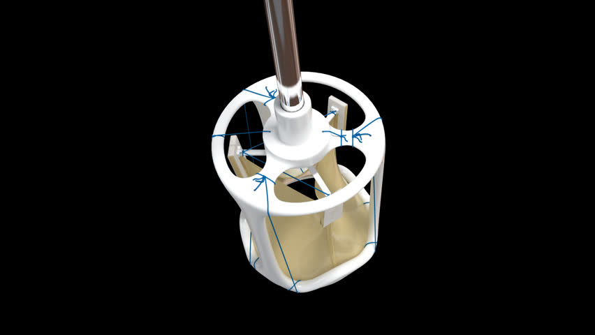 Top to bottom view of artificial human tricuspid valve in 3D which is often used in prosthetic cardiac surgery in stenosis or incompetent valve replacement of aortic valve