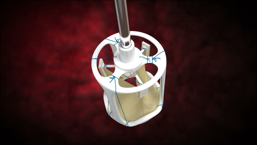 Top to bottom view of artificial human tricuspid valve used in prosthetic cardiac surgery for incompetent valve replacement of aortic valve in 3D model