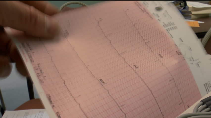 Physicianâs hands guide, rip off patientâs recent EKG reading on electrocardiogram set up in office, close up. 1080p