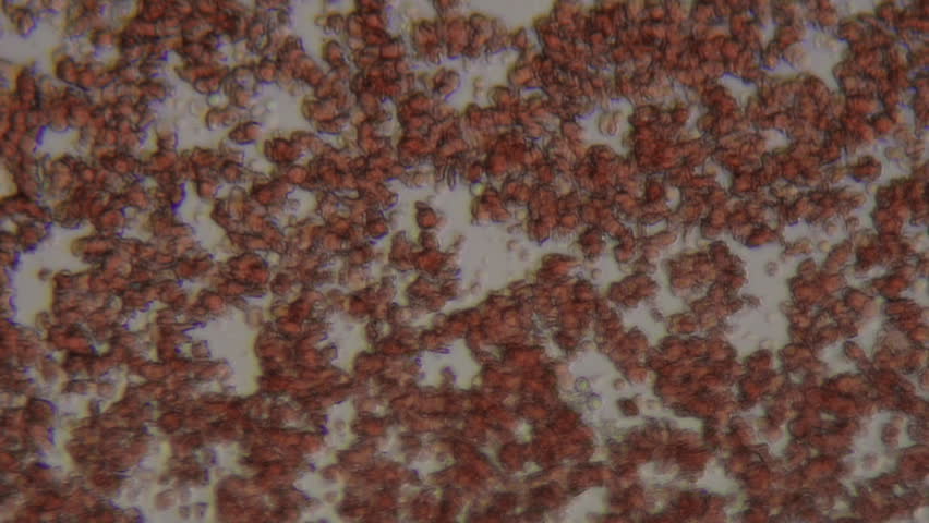 Microscopic macro shot of fresh blood flowing on a slide, light smear, with clear plasma.
