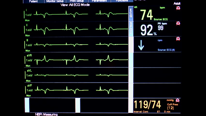 Silhouetted finger of medical specialist pointing at patient monitor, explaining series of ECG or EKG readings. 1080p