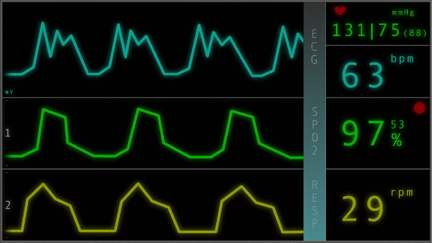 EKG ECG monitor extreme close up macro