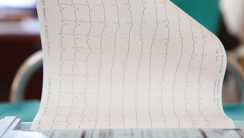 Cardiogram
