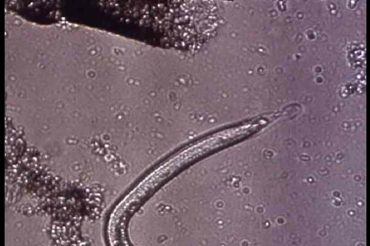 1940s - Microscopic shots of trichinosis and food poisoning in this 1942 film.