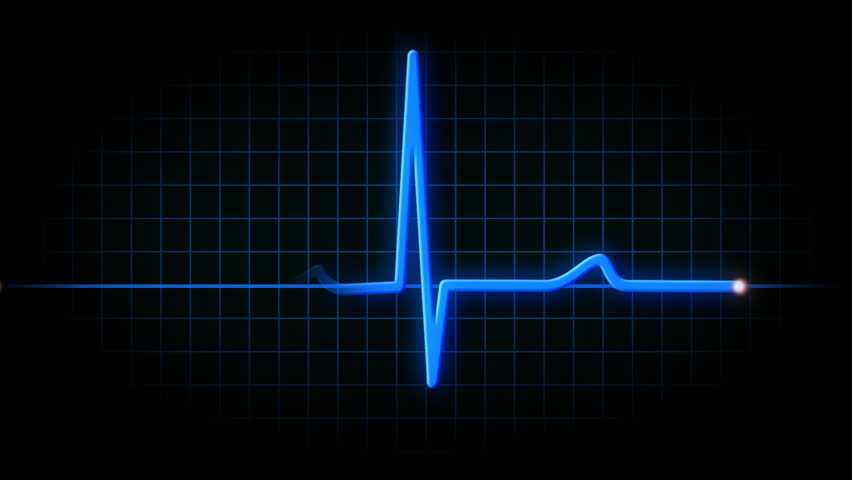 Animated Heart Monitor Ekg Line Sound Stock Footage Video (100%  Royalty-free) 488149 | Shutterstock
