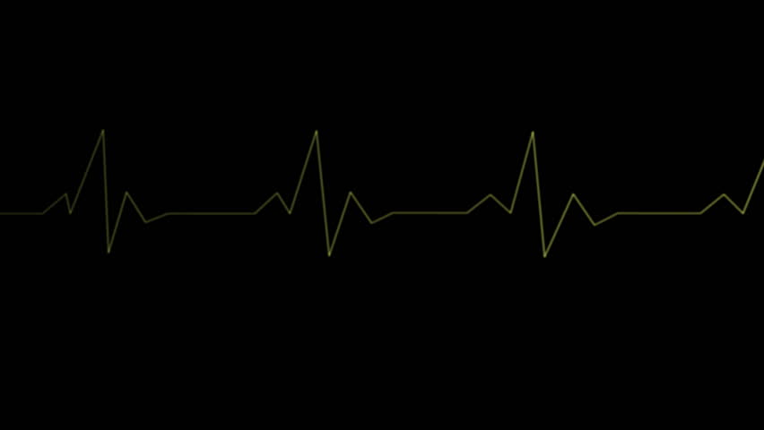 Heart Monitor - Animation