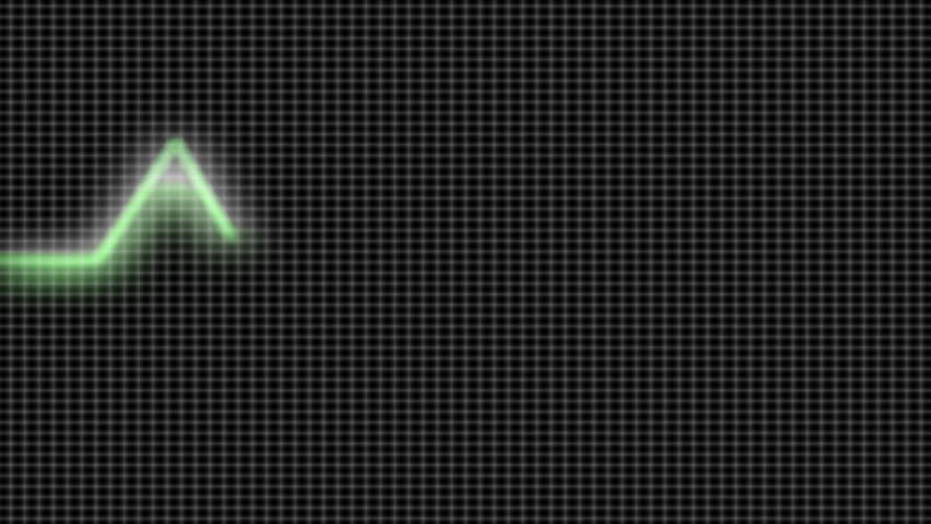 Animated Heart Monitor