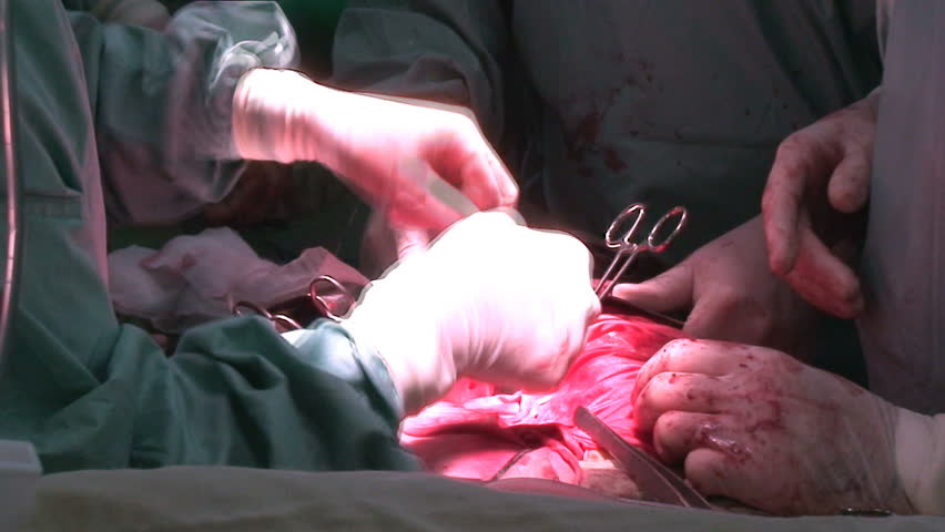 Cardiac surgery in operation room.