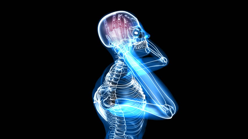 Headache