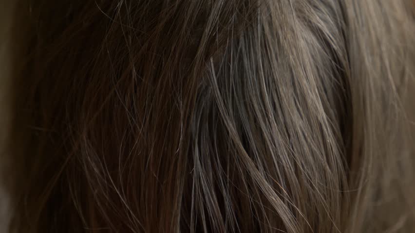 4k00 42close Up 4k Slow Motion Female Hands Finding Lice On