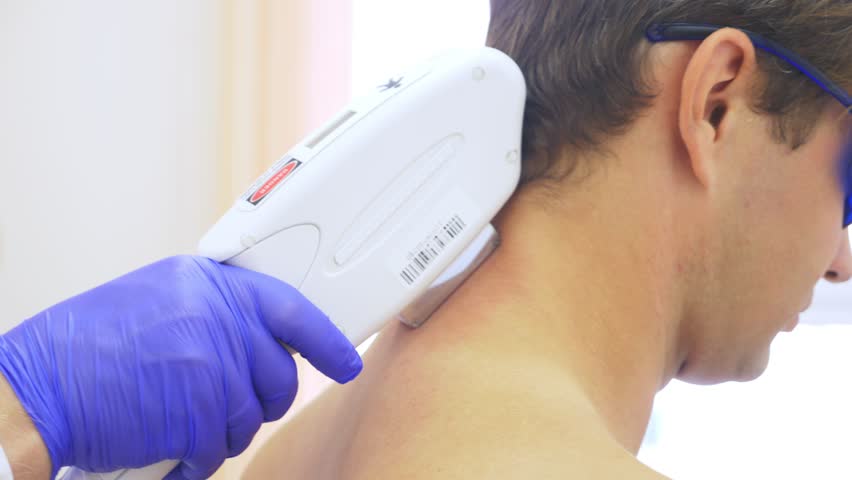 Mens Laser Hair Removal The Stock Footage Video 100 Royalty