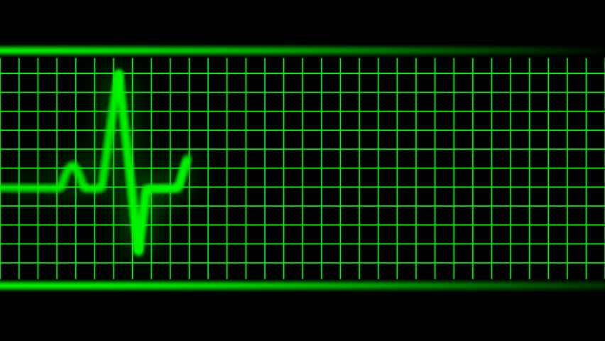 Ekg Pulse Green Hd Seamless Stock Footage Video (100% Royalty-free ...