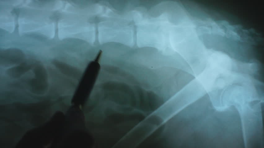 Header of lumbosacral