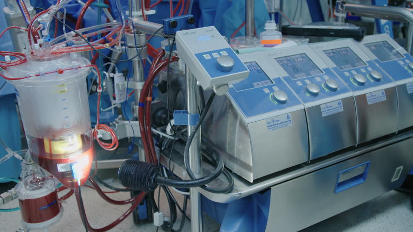 Heart Lung Machine During Heart Stock Footage Video (100% Royalty-free
