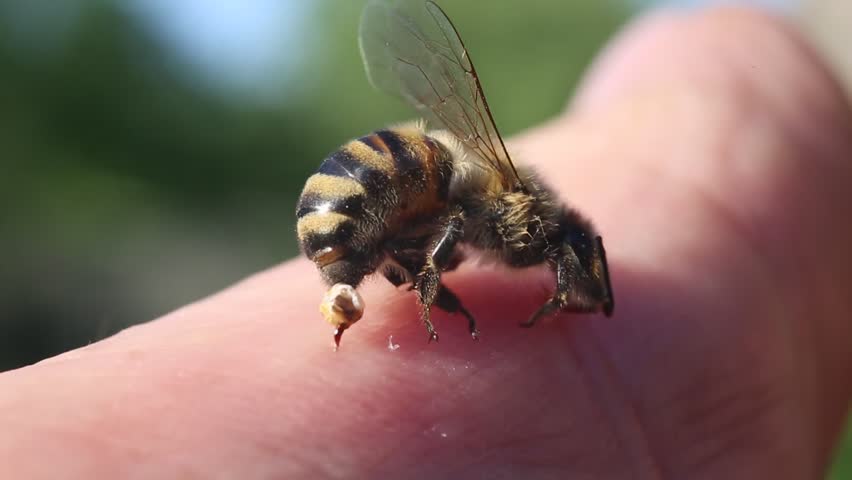 Bee Sting - A Weapon Of Defense And Attack. To Protect Bee Uses The ...