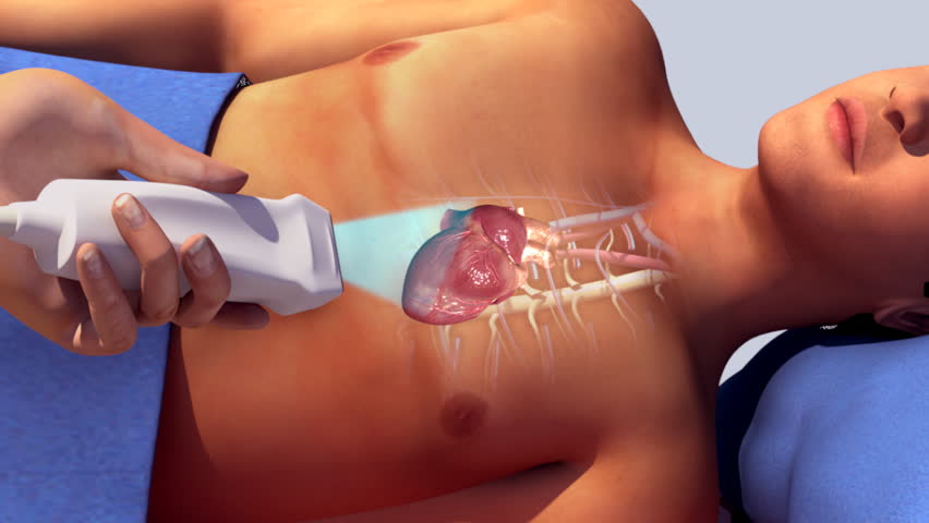 Header of subcostal