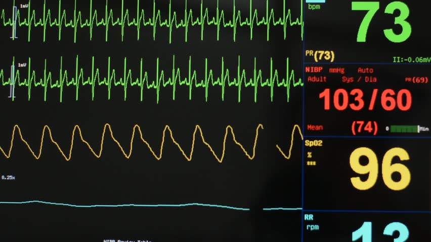 bp monitor in icu