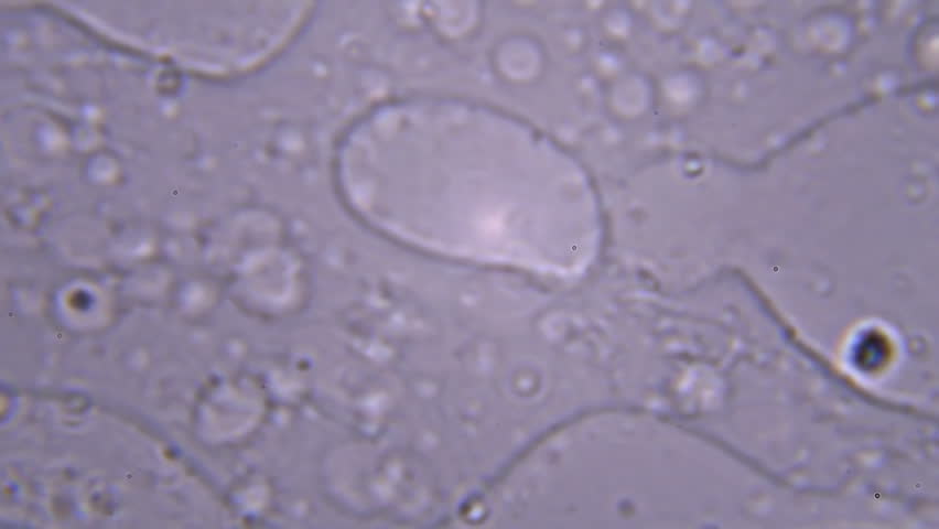 Seeing Sperm Activity Using A Microscope At Extreme Magnification ... Seeing Sperm Activity Using A Microscope At Extreme Magnification ...