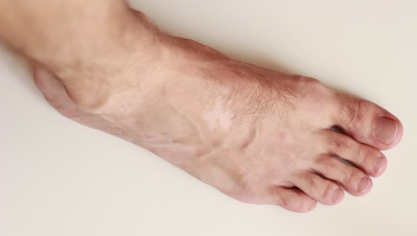 Header of blotch