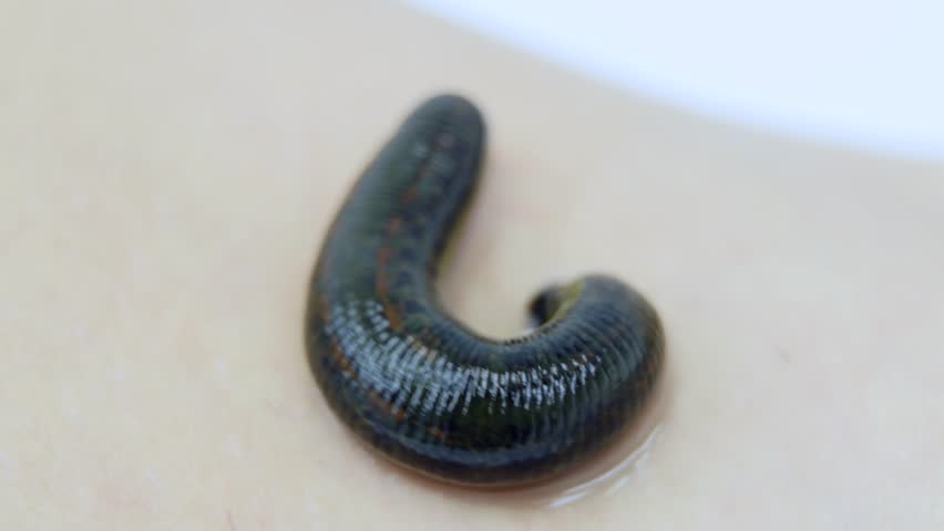 Leech Stock Video Footage - 4K and HD Video Clips | Shutterstock