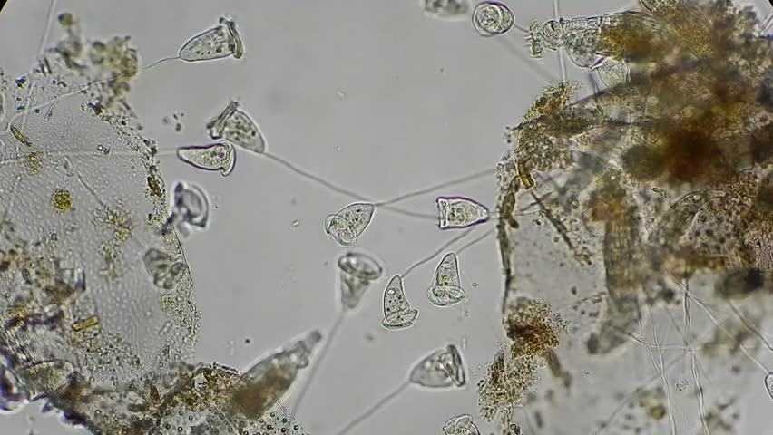 Vorticella And Rotifers Filtrating Water Under Microscope 400x Stock ...
