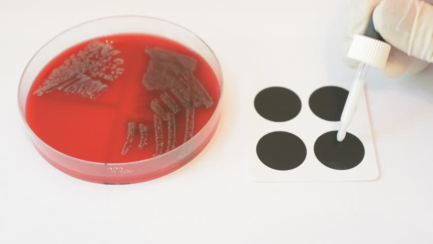 Header of agglutination